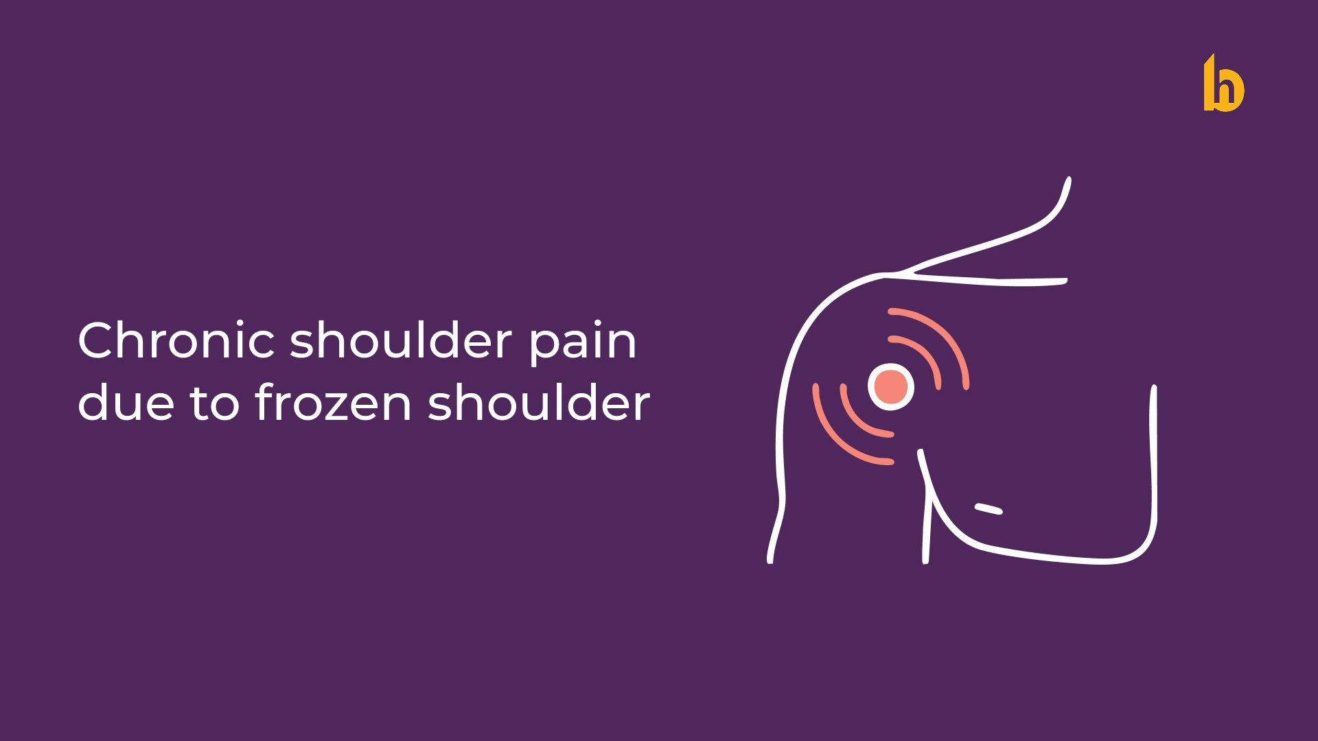 Chronic Shoulder Pain due to Frozen Shoulder