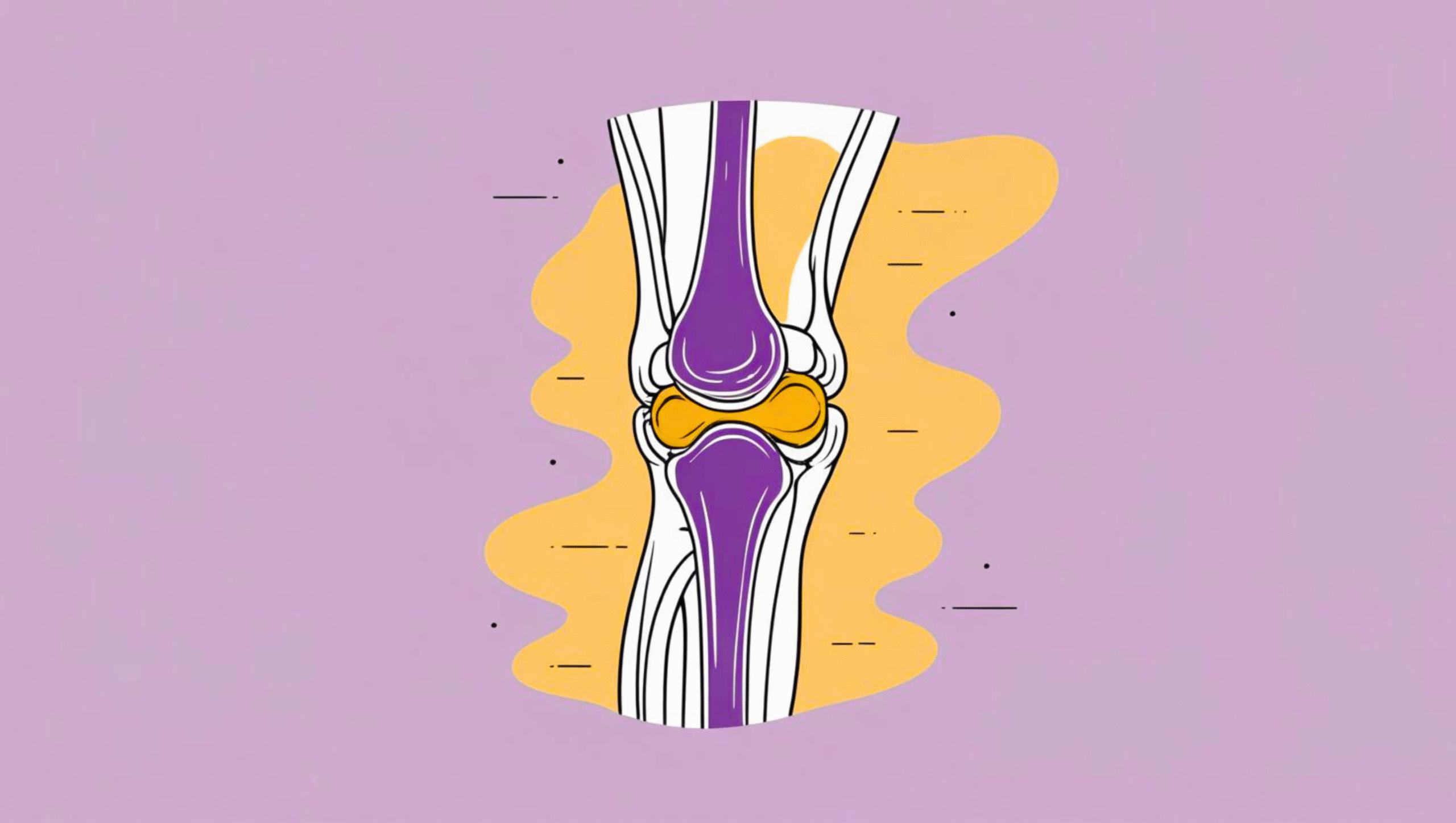 Illustration of a knee joint highlighting inflamed bursae causing chronic knee pain