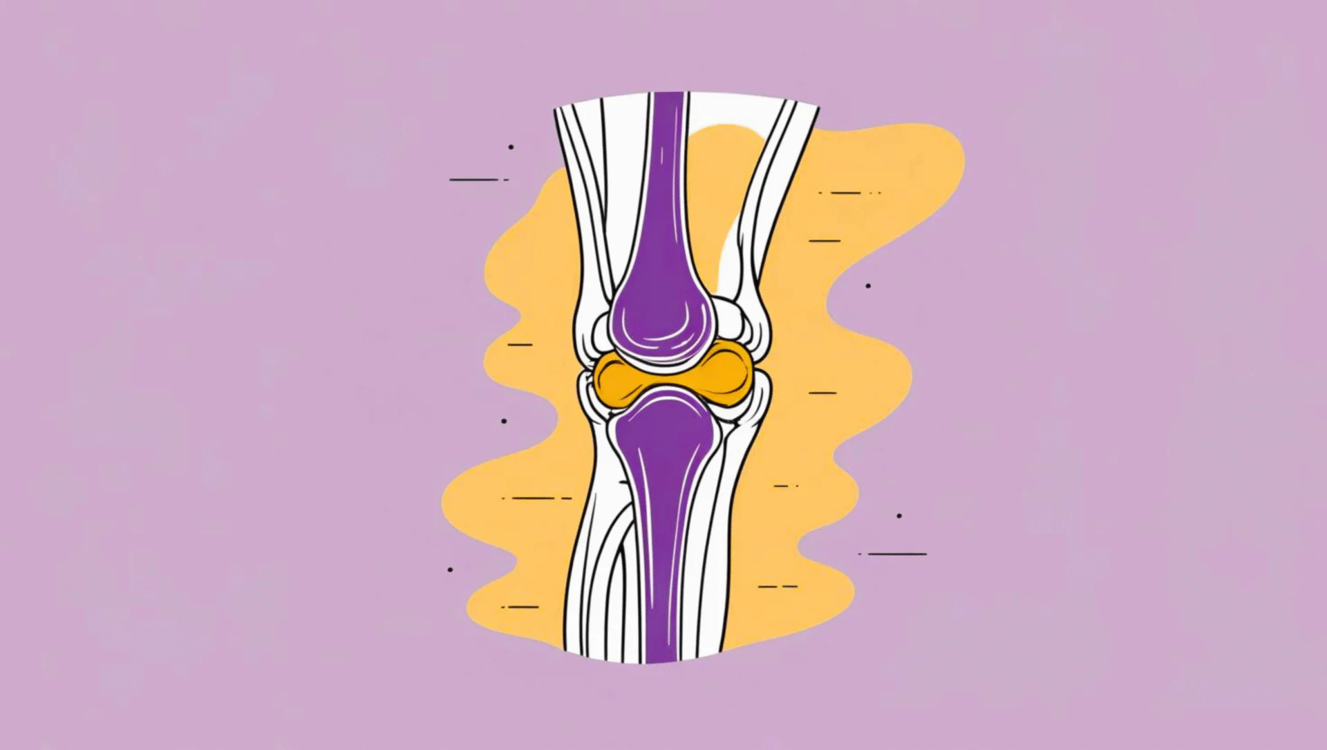 Chronic Knee Pain due to Bursitis: Understanding the Cause