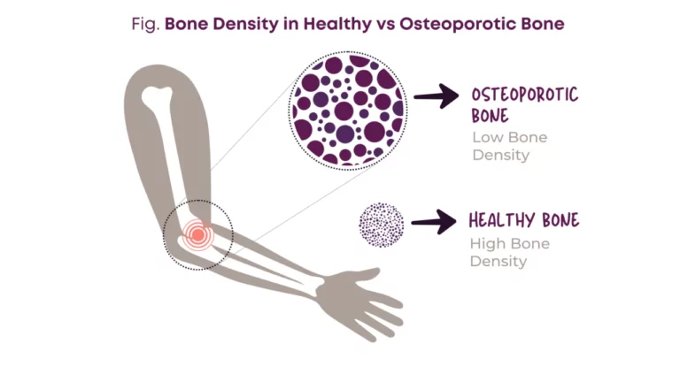 Building Stronger Bones and Joints