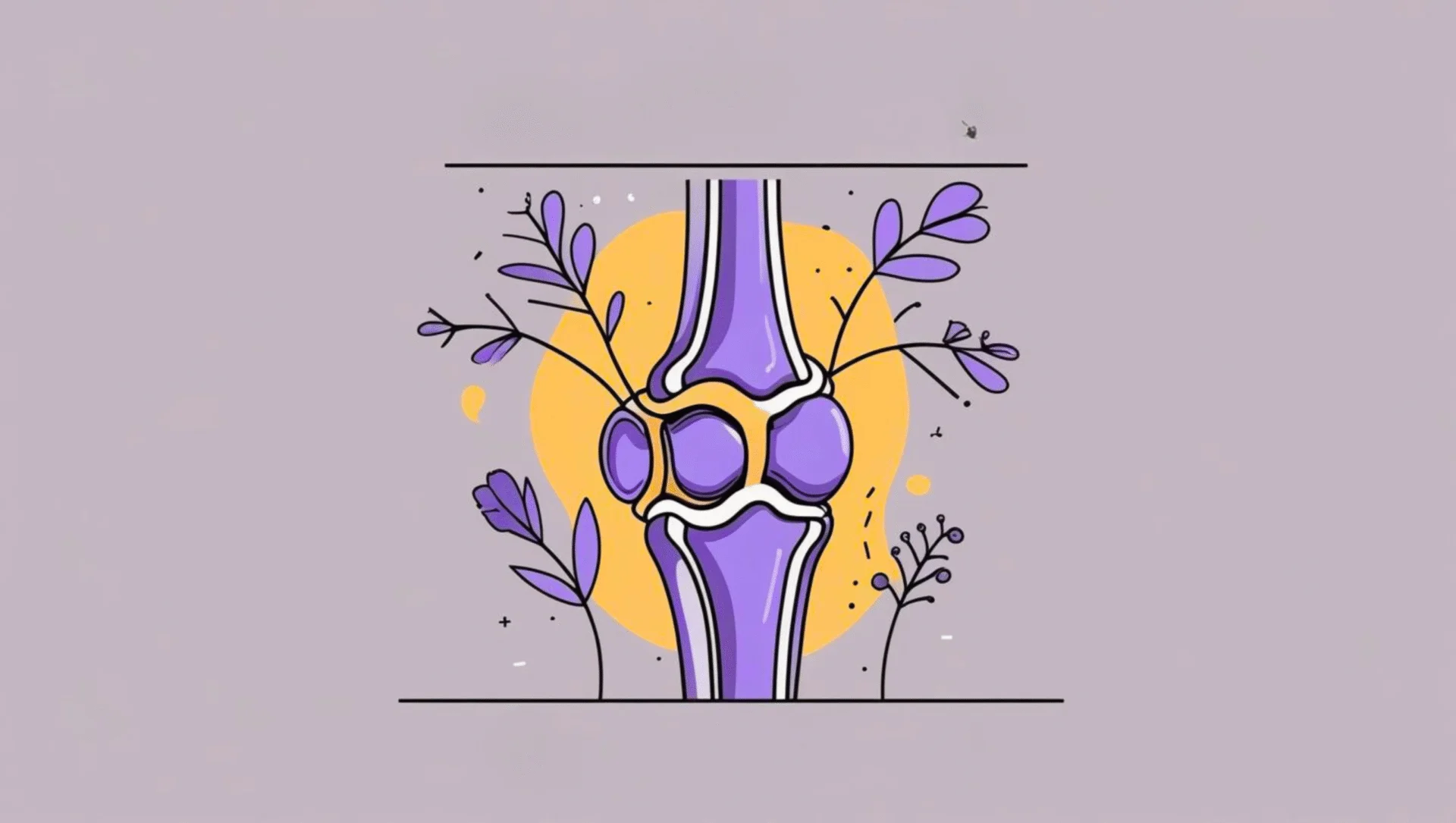 Illustration of a knee joint showing patellar instability as a cause of chronic knee pain.