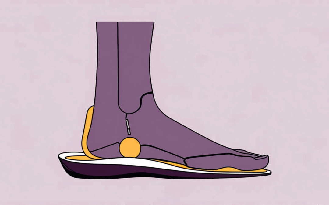 Top Benefits of Arch Support Insoles for Flat Feet