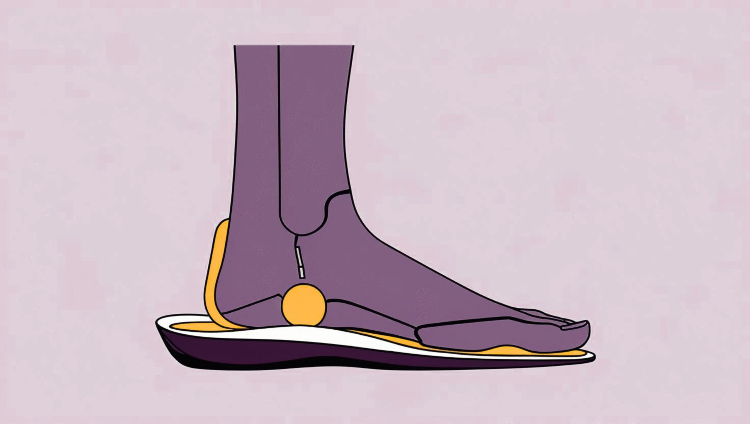 Illustration showing flat feet being supported by arch-support insoles to reduce pain and improve posture.