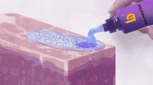 Applying pain relief gel on sore muscles to reduce pain and inflammation