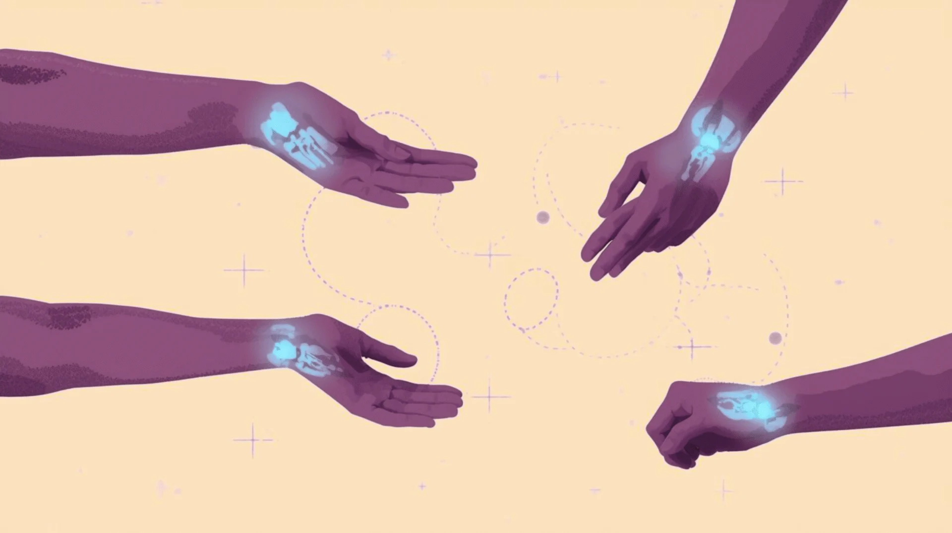 Wrist Pain exercise