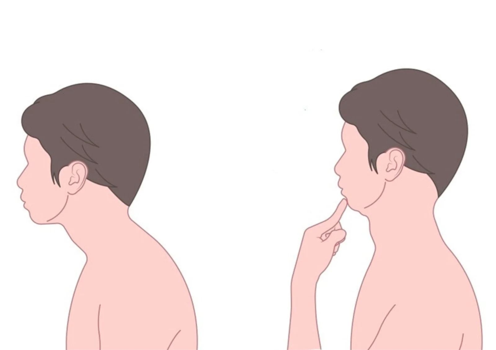 Chin Tucks:- for Tech Neck