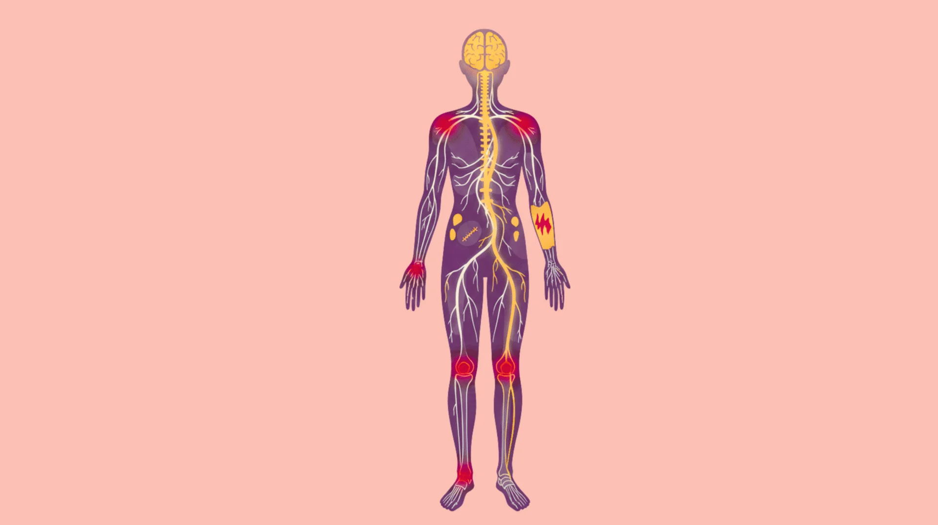 Pain Management Techniques: Effective Strategies for Relief and Better Quality of Life