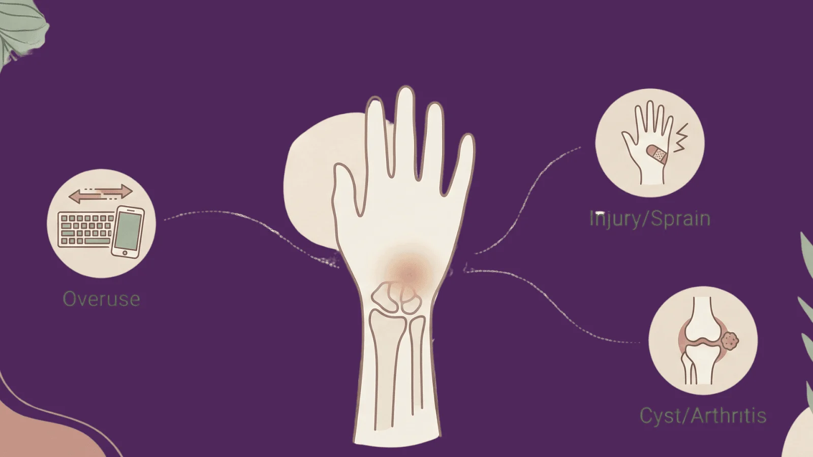 What Causes Dorsal Wrist Pain