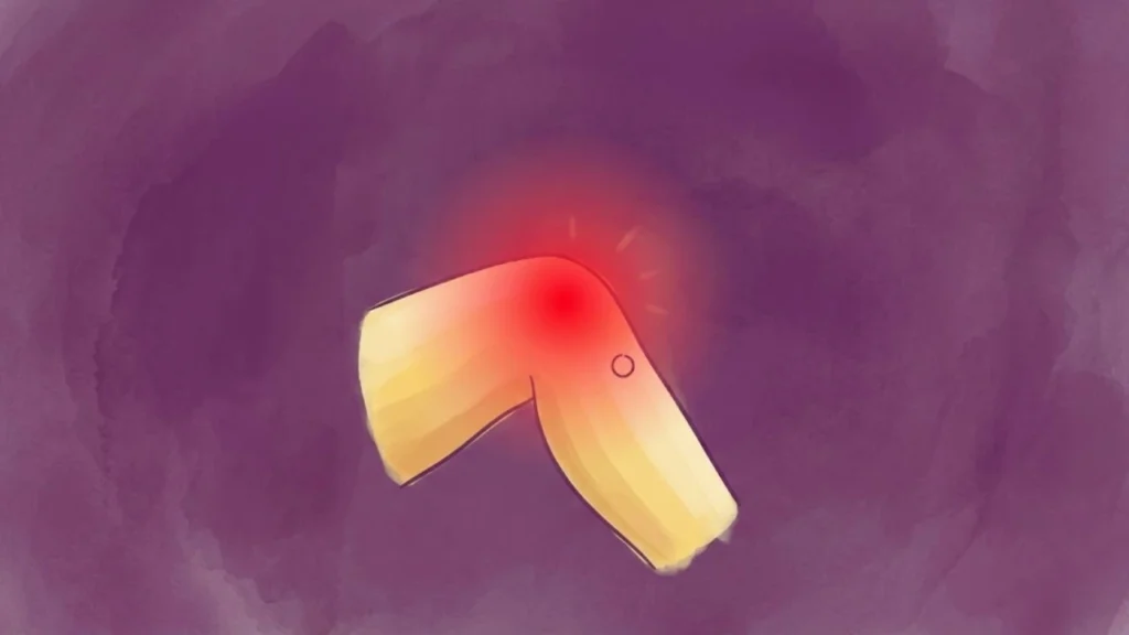 Why Does Knee Pain Happen