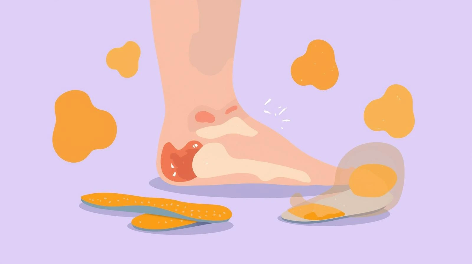Orthotic Insoles for Plantar Fasciitis
